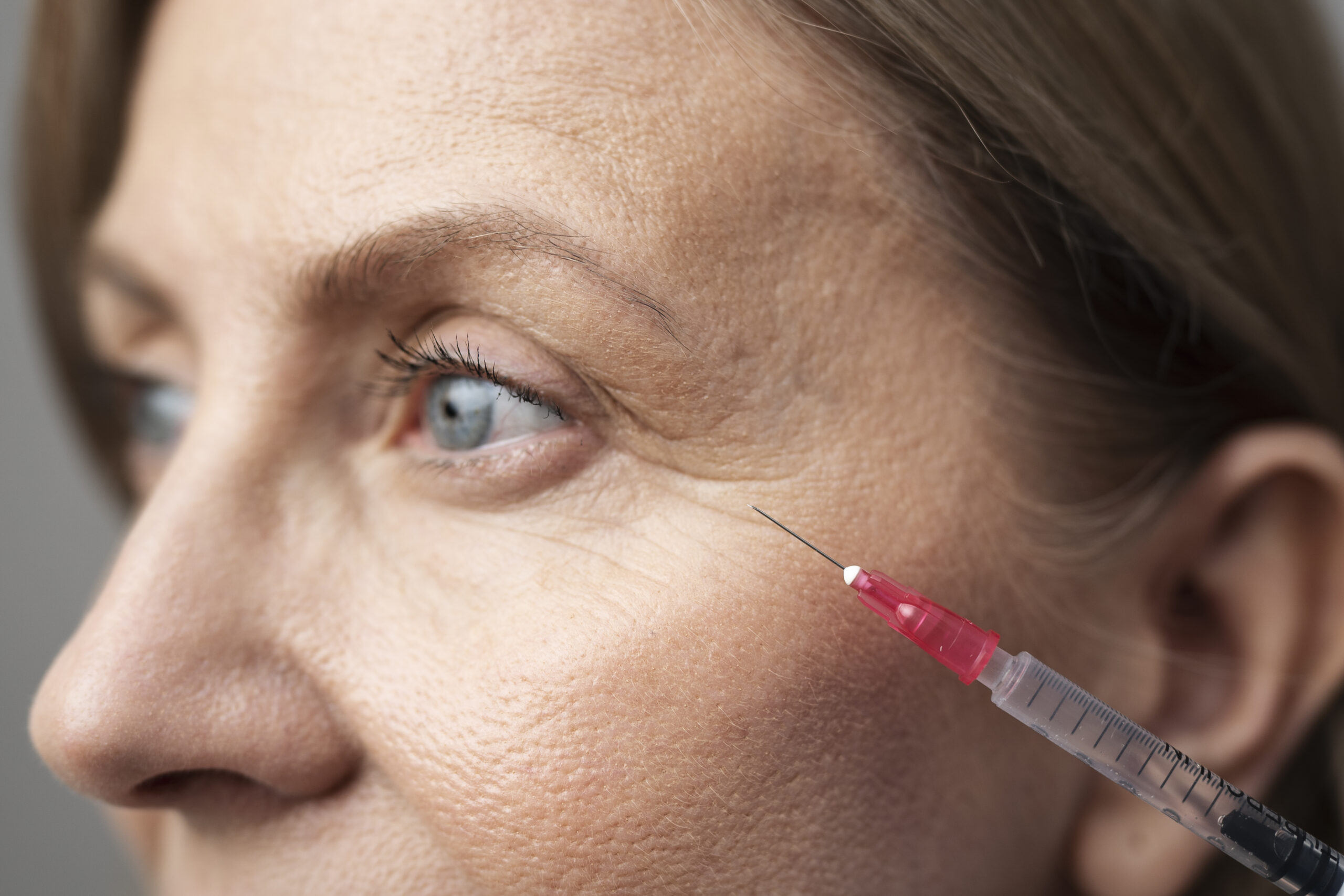 close-up-woman-with-hyaluronic-acid-injection
